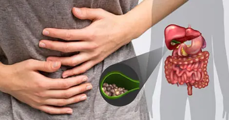  جلوگیری از سنگ‌های کلیه و صفرا با این روغن 