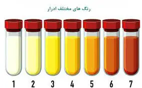 رنگ و بوی ادرار اگر این علائم را داشت شما بیمارید

