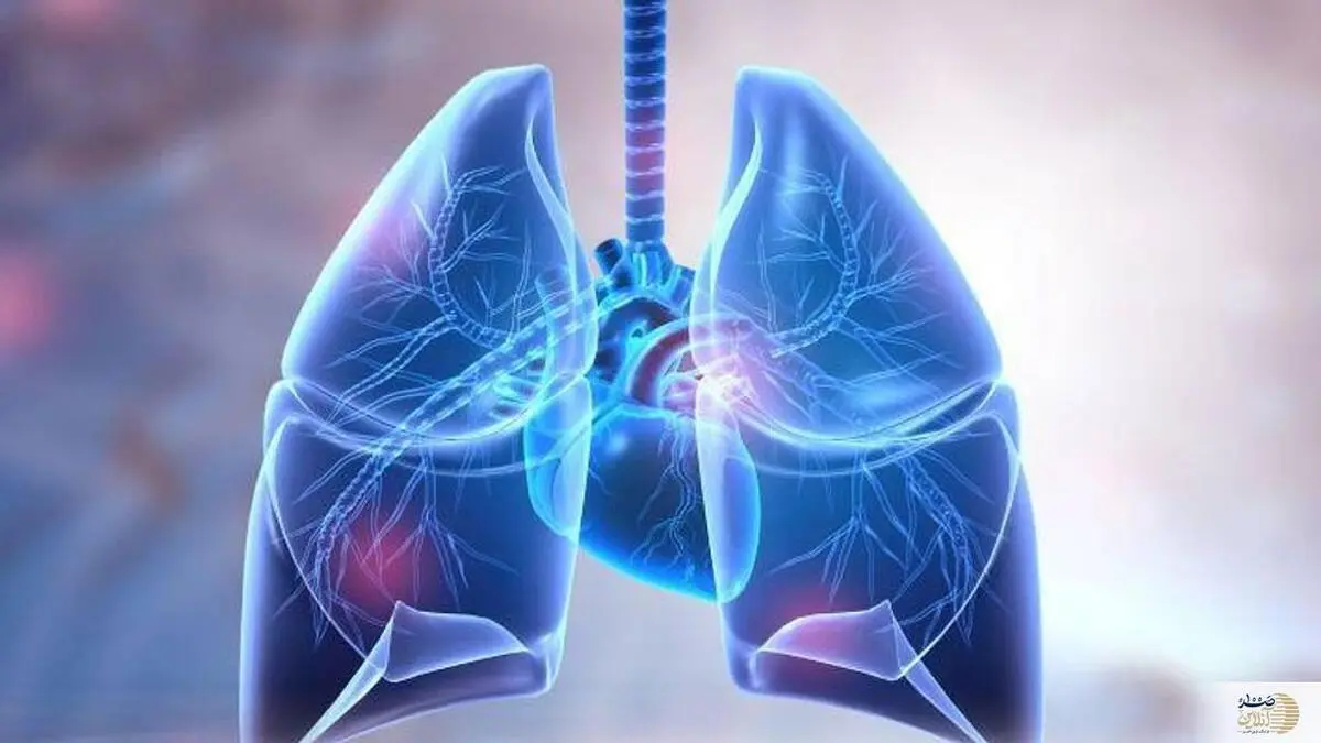 هشدار ! این افراد در معرض ابتلا به بیمارى هاى ریوى

