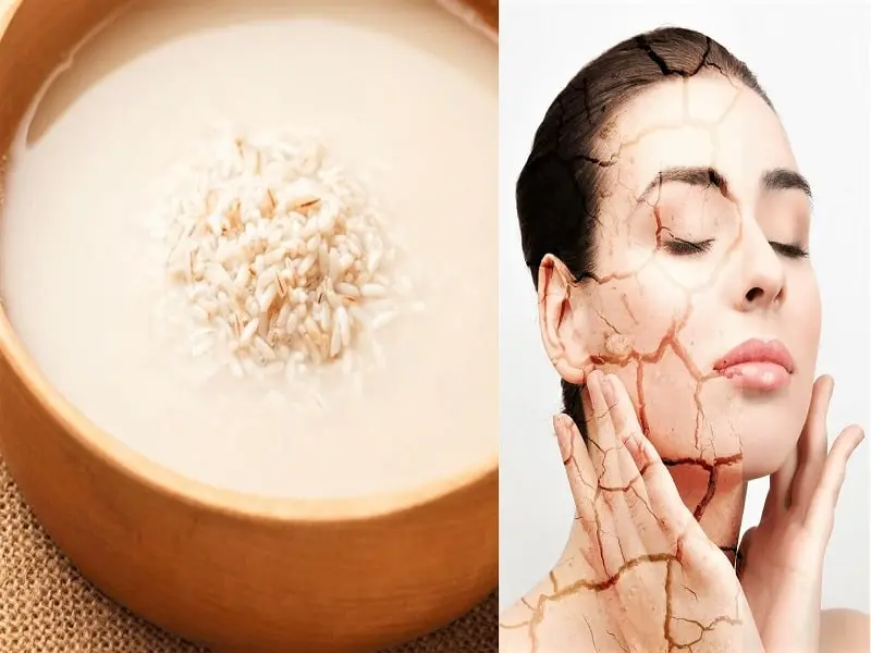 Benefits-and-Uses-of-Rice-Water-For-Face-and-Glowing-Skin-Beauty-Tips-By-Nim-Nimisha-Goyal-HashBUGS-BTN-Nimify-Beauty-beautytipsbynim.com-2