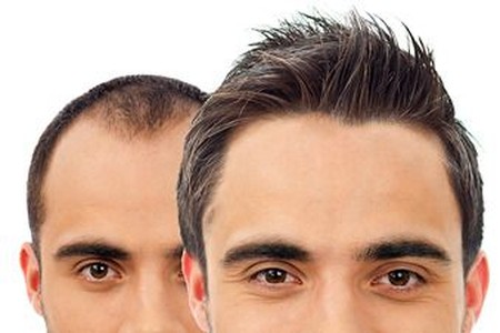  پایان ریزش مو فراهم شد/ ترکیب این دو روغن طبیعی رشد مو‌ها را چند برابر می‌کند 