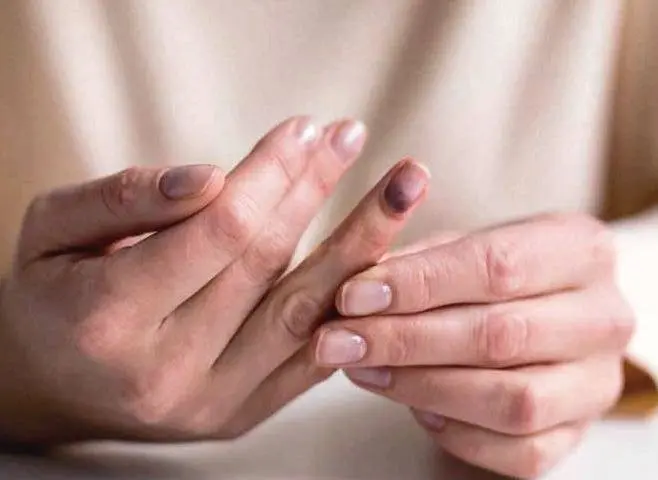 به جای چکاپ کامل بدن با هزینه زیاد با این ترفند تو 30 ثانیه کل مشکلات بدنت رو کشف کن