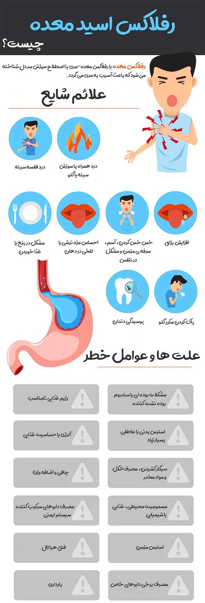 رفلاکس معده