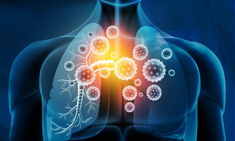 پاکسازی کامل ریه در عرض سه روز فقط با این شربت خانگی و طبیعی 