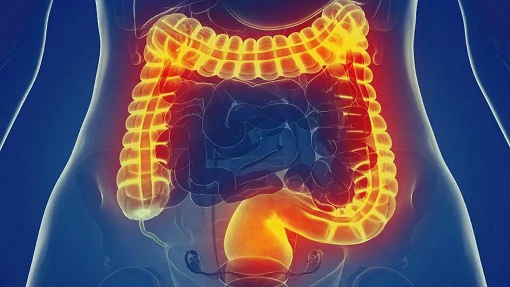  این علائم می گوید روده شما ناسالم است 