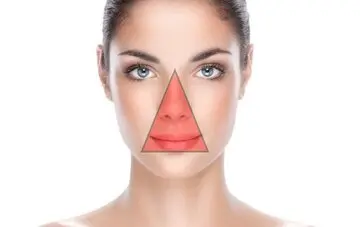 مثلث مرگ در صورت |  درآوردن جوش‌های سرسیاه در این ناحیه خبر از مرگ زودرس می دهد