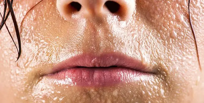 علت عرق زیاد سر و صورت چیست؟ / بررسی جامع علل و نحوه درمان