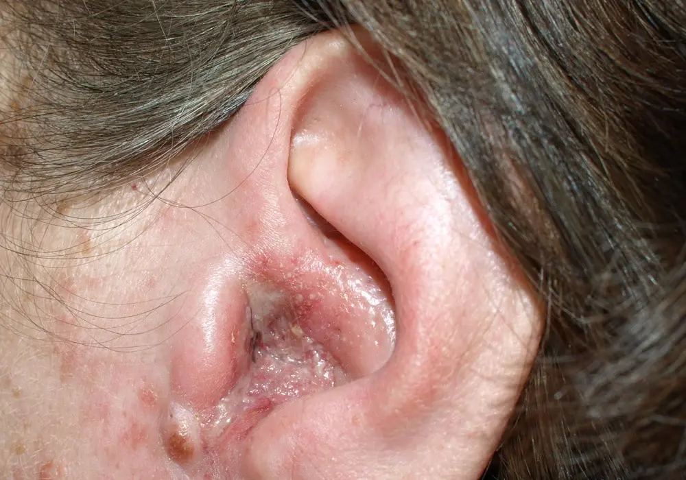 درد، فشار و سردرد؟ این علائم را جدید بگیرید؛ گوش شما در خطر است