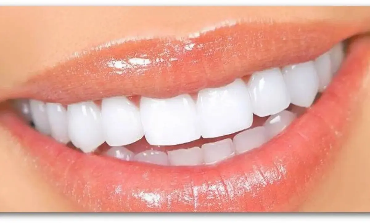 پوست این میوه کار جرم گیری دندان پزشک ها را میکند + 10 ترفند خانگی دیگر که بدون هزینه دندان شما را برق می اندازد