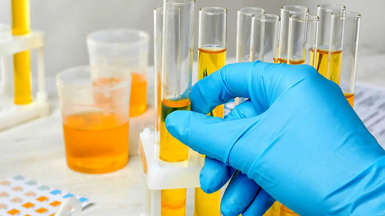  کدام تغییر رنگ ادرار خطرناک است؟ 