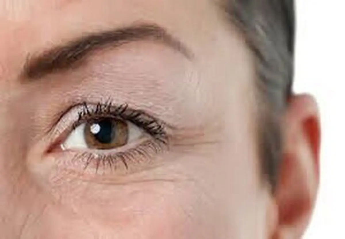 چین و چروک‌ها بر روی صورت شما زیاد شده است ؟ بخوانید
