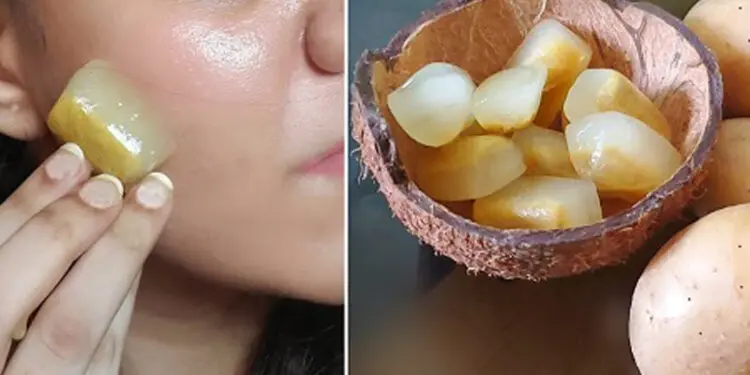 بوتاکس صورت با یخ سیب زمینی