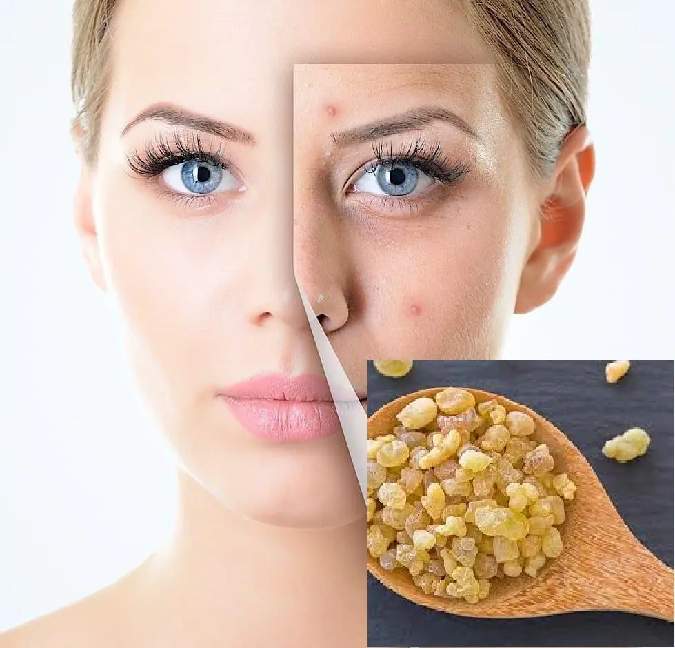 خواص ضدپیری این گیاه ارزشمند؛  لیفت و درخشندگی و جوان‌‌سازی پوست با کندر