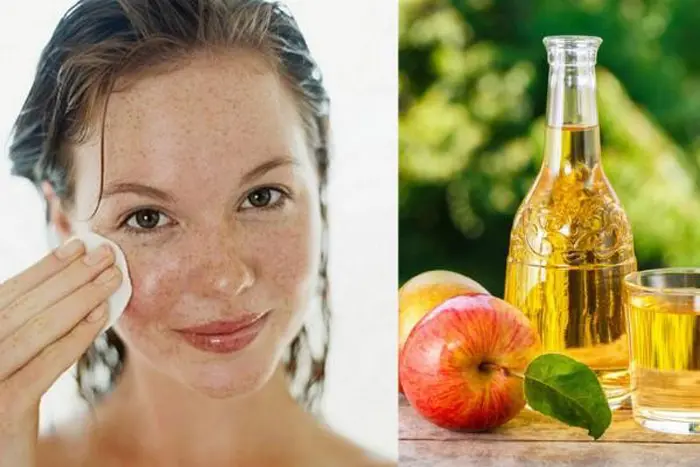 سرکه سیب برای پوست؛ دشمن آکنه و لک‌های پوستی