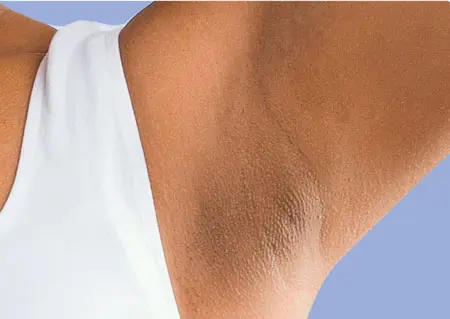 رفع تیرگی زیر بغل با چند ترفند جادویی و خانگی | این مواد خونگی و ارزان قیمت کمتر از یک روز همه تیرگی های پوستتو از بین میبره