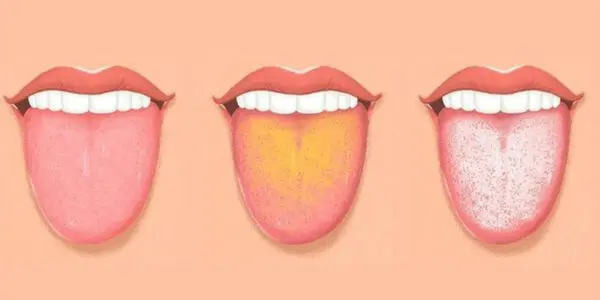 دیگه برای تشخیص بیماری ها نیاز به آزمایش و چکاپ گران قیمت نیست | بگو زبونت چه رنگیه تا تمام مشکلات بدنت رو بگم