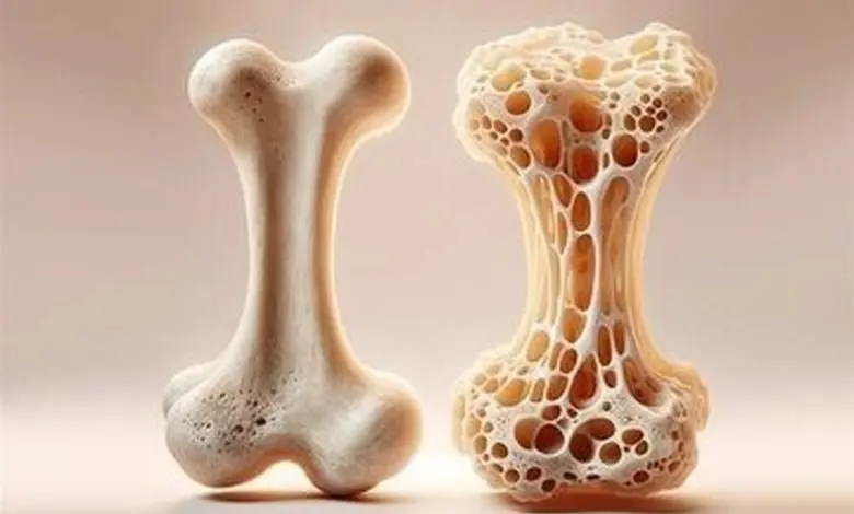 با این ویتامین‌ها استخوان‌های قوی بسازید!