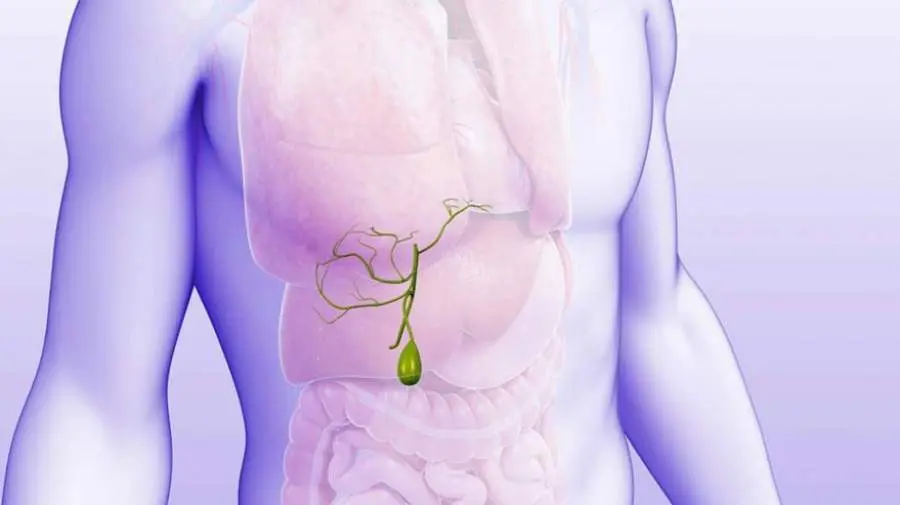 این مواد غذایی کیسه صفراتو نابود میکنه! | تهدید سلامت کیسه صفرا با مصرف چند ماده غذایی