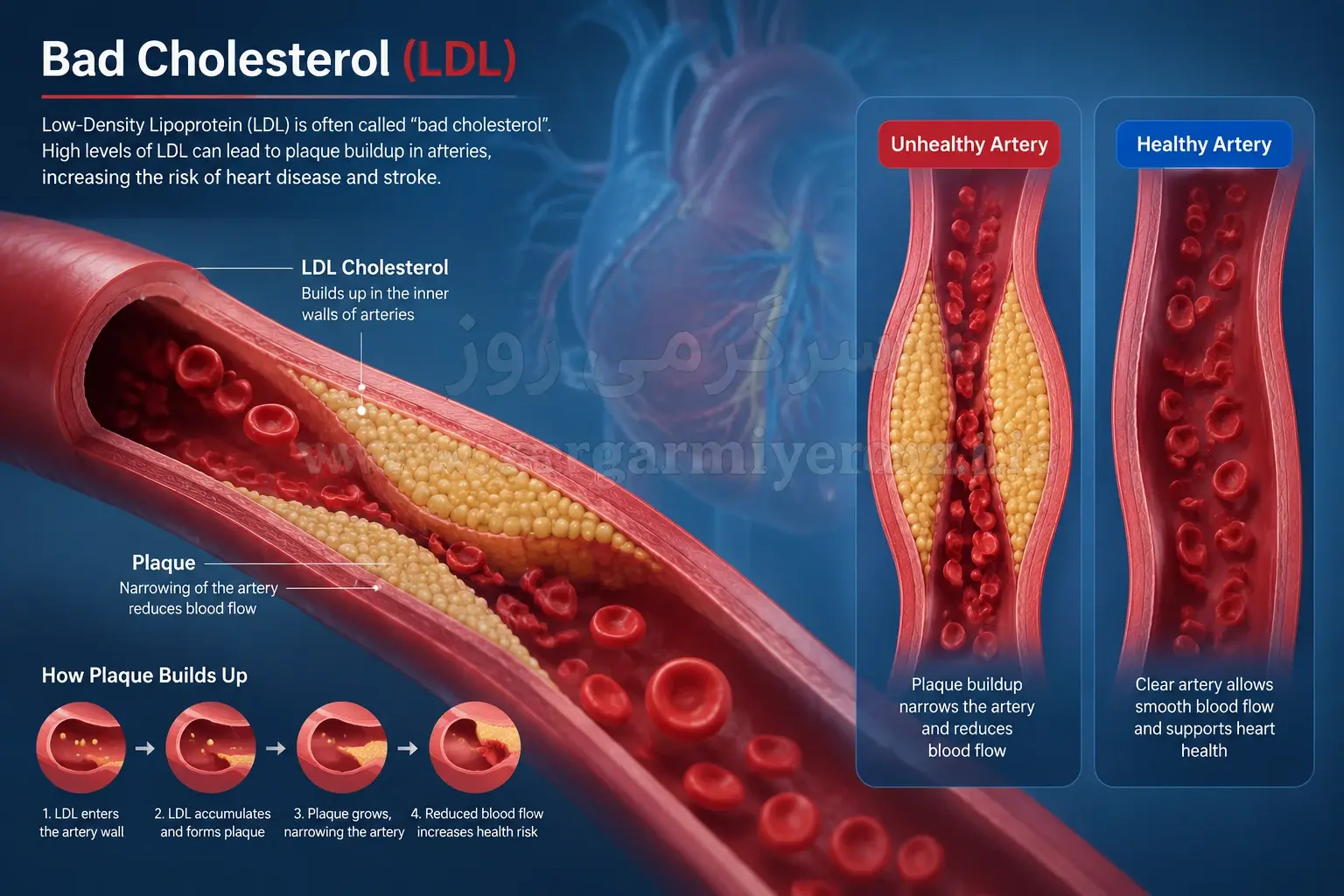 چگونه LDL (کلسترول بد) خون را کاهش دهیم؟