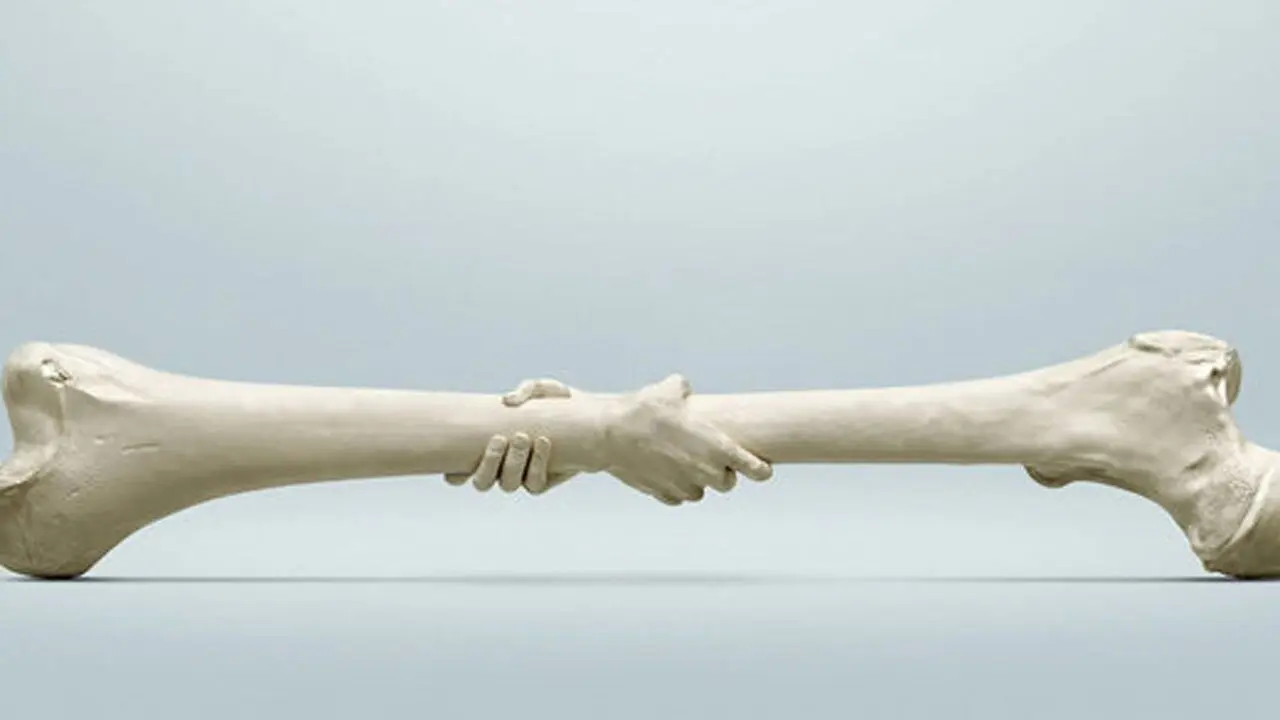  مراقب استخوان‌هایتان باشید | امکان شکستگی استخوان در این افراد بیشتر است 