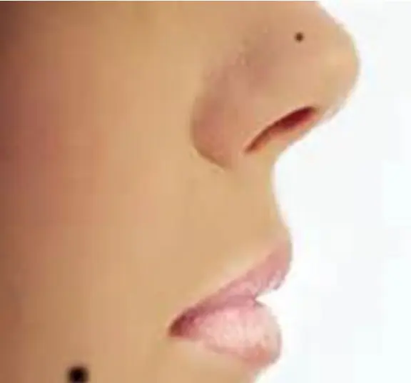 طالع بینی: زنانی که در این طرف بینی خود خال دارند،تمام خانواده را ثروتمند می کنند!