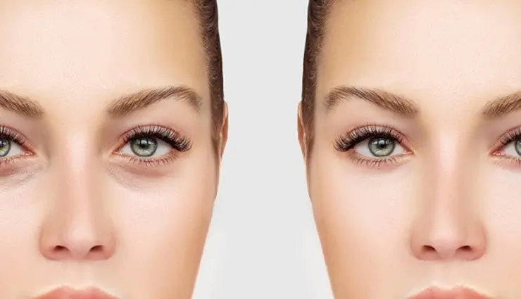 روغن آفتابگردان برای جوانسازی زیر چشم