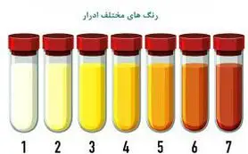 رنگ و بوی ادرار اگر این علائم را داشت شما بیمارید

