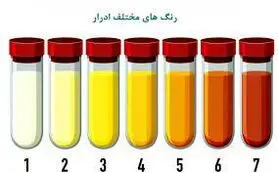 رنگ و بوی ادرار اگر این علائم را داشت شما بیمارید

