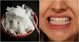 بدون نیاز به هزینه های سرسام آور دندان پزشکی دندوناتو مثل برف سفید کن | یک روش خانکی و بسیار ارزان برای داشتن دندان بلوری