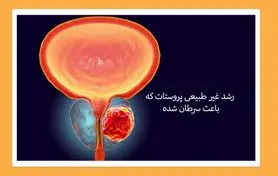  این کار خطر ابتلا به سرطان پروستات را کاهش می دهد 