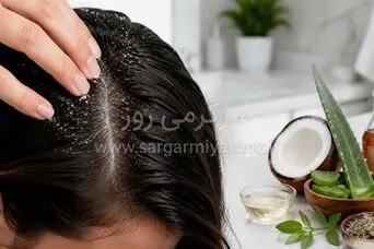با این اسپری طبیعی شوره سر را در خانه درمان کنید!