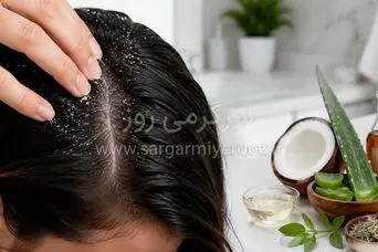 با این اسپری طبیعی شوره سر را در خانه درمان کنید!