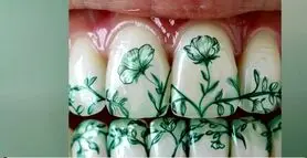 عجایب جدید مد و فشن ؛ خالکوبی روی دندان!