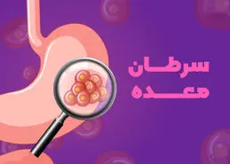 سوزش سردل همراه با این علائم نشانه سرطان معده است |  با این راهکارها از سرطان معده در امان بمانید