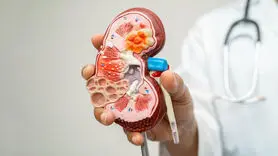 نگران سلامتی کلیه‌هات نباش! | این ۶ خوراکی بی‌نظیر برای کلیه معجزه می‌کنه
