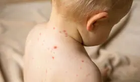 هشدار جدی، اگر این علائم را دارید خونتان عفونت کرده است