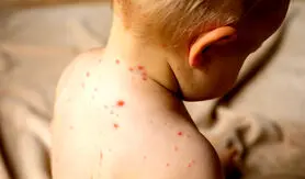 هشدار جدی، اگر این علائم را دارید خونتان عفونت کرده است