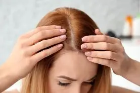 با این شامپوی کاملا خانگی و ارزان قیمت برای همیشه با موهای چربت خداحافظی کن