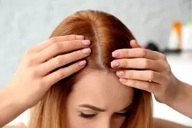 با این شامپوی کاملا خانگی و ارزان قیمت برای همیشه با موهای چربت خداحافظی کن