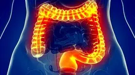  این علائم می گوید روده شما ناسالم است 