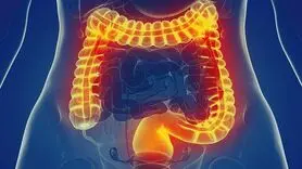  این علائم می گوید روده شما ناسالم است 