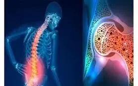 استخوان‌های محکم و قوی می خواهید ؟ این ویتامین راه حل شماست 