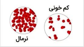 قاتل کمخونی شناسایی شد |  این سبزی قاتل کم خونی و کمبود آهن 