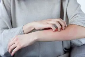 چه ارتباطی بین خارش و بیماری‌های کبدی وجود دارد؟