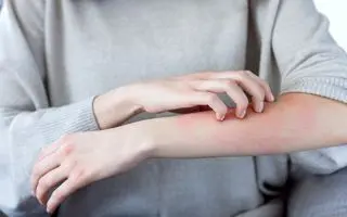 هشدار پزشکی: اولین نشانه سرطان خارش در این نقاط بدن است