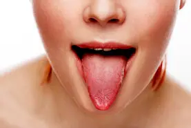 اگر سوزش زبان دارید بدانید وضع بحرانی است