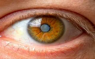 پیشگیری از آب مروارید با این راهکارهای ساده