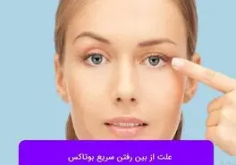میخوای عمر بوتاکس دو برابر شه این مطلبو از دست نده
