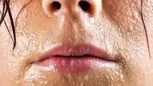 علت عرق زیاد سر و صورت چیست؟ / بررسی جامع علل و نحوه درمان
