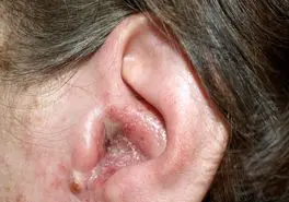 درد، فشار و سردرد؟ این علائم را جدید بگیرید؛ گوش شما در خطر است